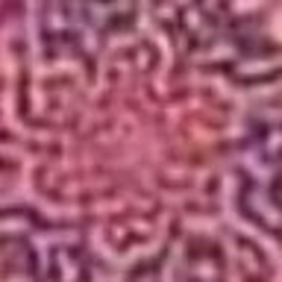 acrabtree5
